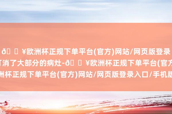 🔥欧洲杯正规下单平台(官方)网站/网页版登录入口/手机版靶向疗养打消了大部分的病灶-🔥欧洲杯正规下单平台(官方)网站/网页版登录入口/手机版