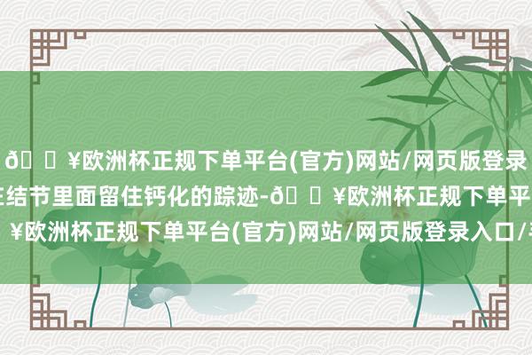 🔥欧洲杯正规下单平台(官方)网站/网页版登录入口/手机版最终可能在结节里面留住钙化的踪迹-🔥欧洲杯正规下单平台(官方)网站/网页版登录入口/手机版